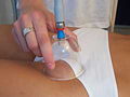 Vacupressový masážny prístroj